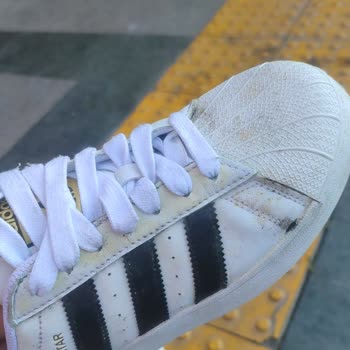 Adidas'a İncelemeye Gönderdiğim Ayakkabımın Küflü Pis Geri Gelmesi