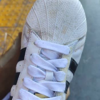 Adidas'a İncelemeye Gönderdiğim Ayakkabımın Küflü Pis Geri Gelmesi