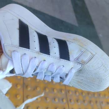 Adidas'a İncelemeye Gönderdiğim Ayakkabımın Küflü Pis Geri Gelmesi