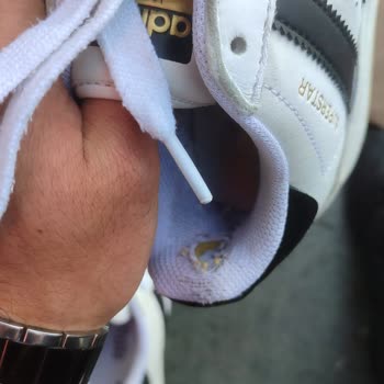 Adidas'a İncelemeye Gönderdiğim Ayakkabımın Küflü Pis Geri Gelmesi