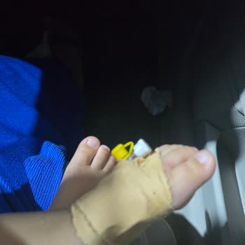 Eti Gıda Bozuk Ürün Ve Sağlık Sorunu Yaşadık