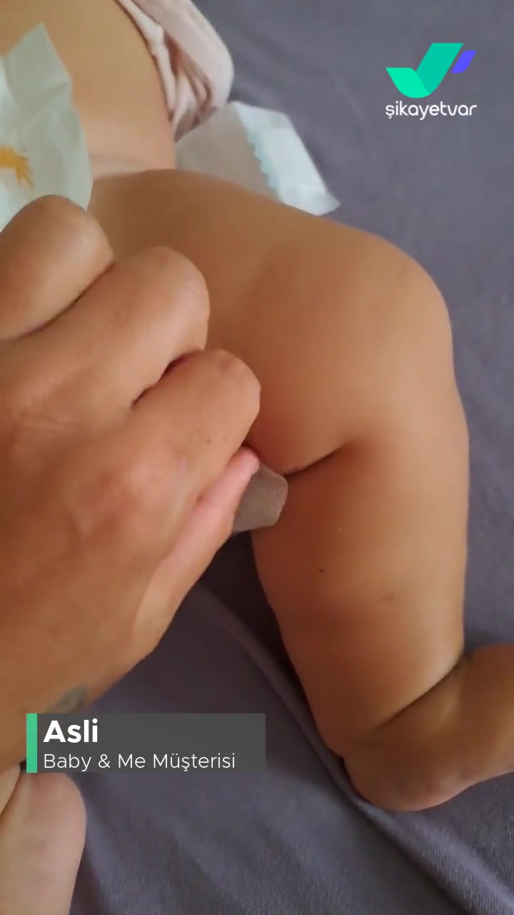 Baby & Me Bebek Bezi Sorunlu videonun kapak resmi