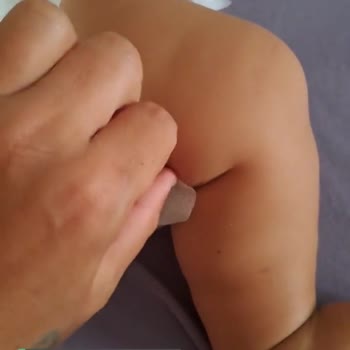 Baby & Me Bebek Bezi Sorunlu