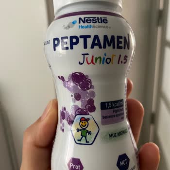 Nestlé İyi Büyüsün İyi Yaşasın Peptamen Junior 1.5 Mama Tadında Sorun