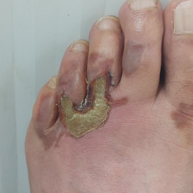 Sporpark Slazenger Marka Ayakkabı Modelleri