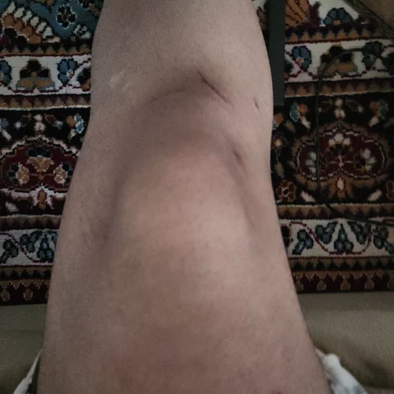 Dedeman Hotels Van Dedeman Otelde Oğlumun Yaralanması