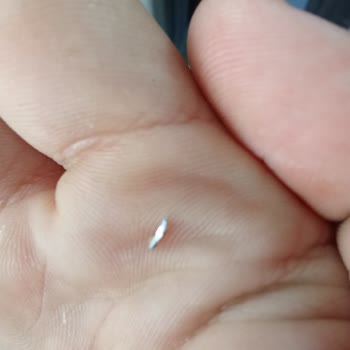 BİM Marketten Alınan Tatlıdan Metal Parça Çıktı