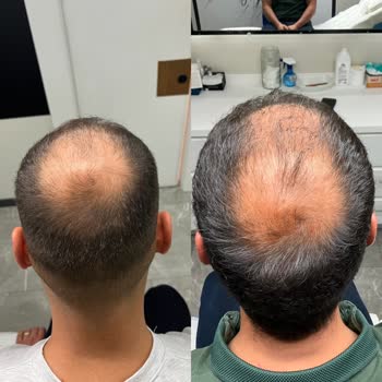 Novar Poliklinik Kök Hücre Yaptırmayın