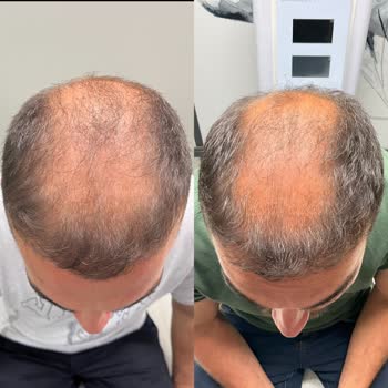 Novar Poliklinik Kök Hücre Yaptırmayın