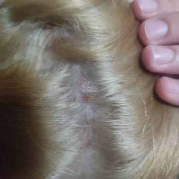 Palette 10.01 Küllü Sarı Saçlarımın Dibi Yara İçinde Kaldı