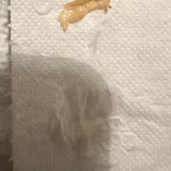 Pepsi Kolanın İçinden Ne Olduğunu Anlamadığım Bir Şey Çıktı