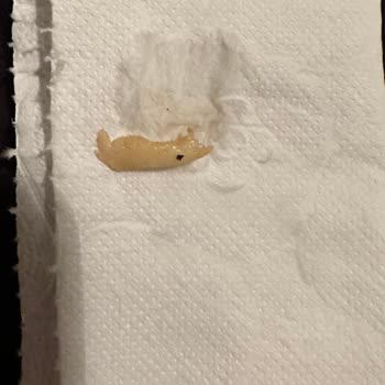 Pepsi Kolanın İçinden Ne Olduğunu Anlamadığım Bir Şey Çıktı