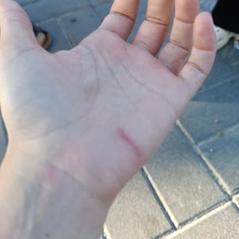 Bungalov.com.tr Güvenlik Sorunları Ve Saldırgan Köpekler: Korkunç Bir Glamping Deneyimi!