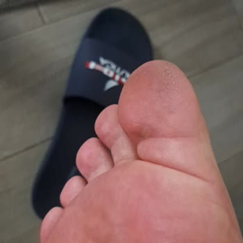Nautica Terlik Ayağımı Yara Yaptı