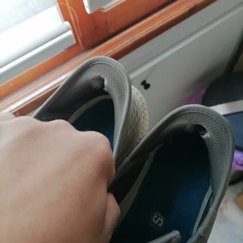 Skechers Marka Ayakkabının Arka Kısmının Deforme Olması