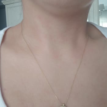 Bargello Perfume Bargello İçeriği Değişmiş Alerji Yaptı