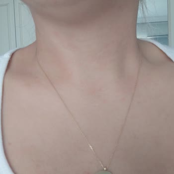 Bargello Perfume Bargello İçeriği Değişmiş Alerji Yaptı