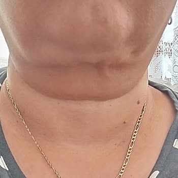 Op. Dr. Duygu Aksoy Beklentim Karşılanmadı. Çok Üzgünüm