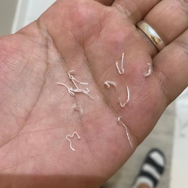 Halıca Halı İncelemesi Sorunu Ve Kullanıcı Hatası İddiası