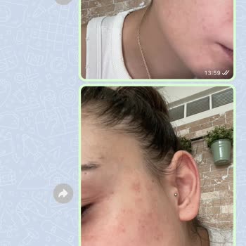 Bahar Beauty Nail Studio Cilt Bakımı Hizmetinde Memnuniyetsizlik Ve İletişim Sorunları