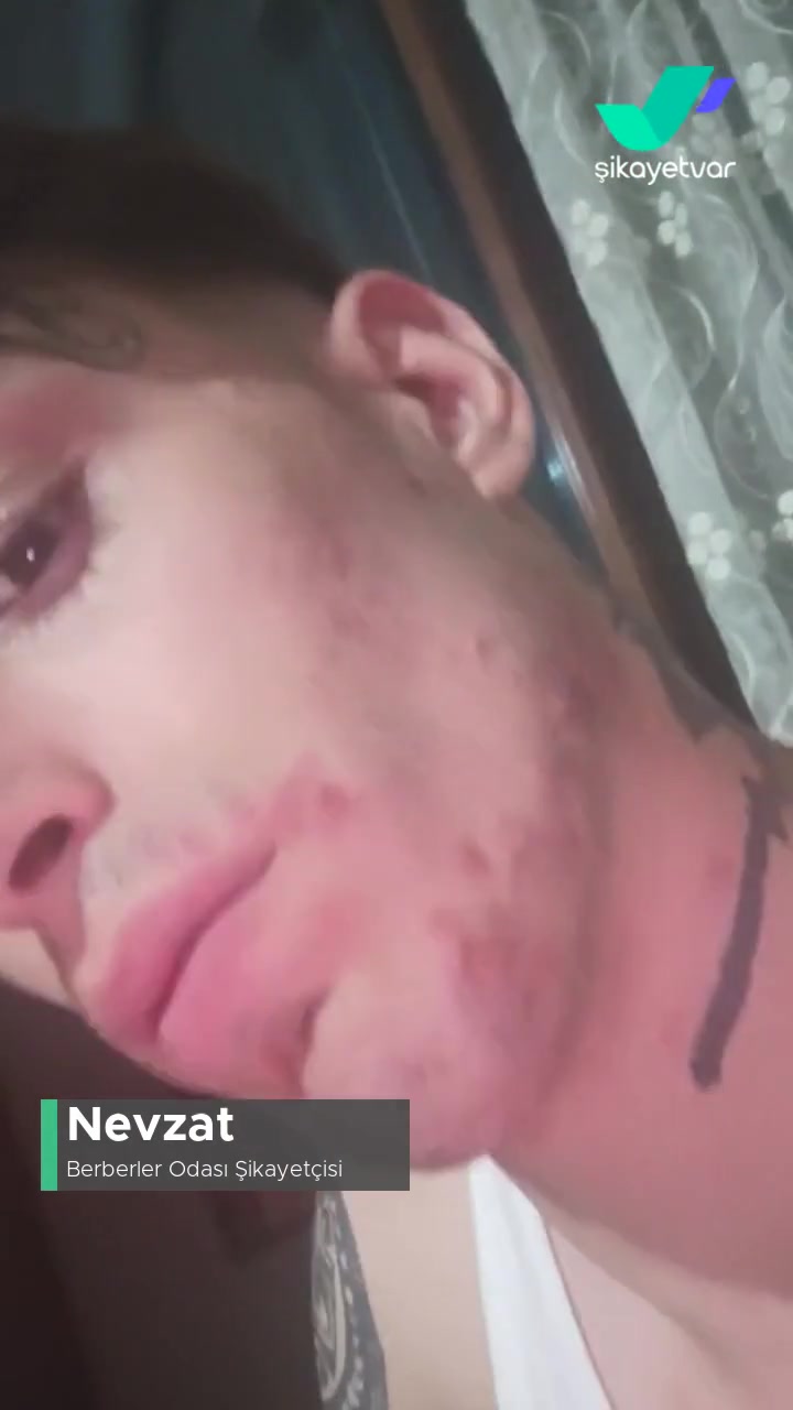 Berberler Odası Suratım İltihap Kaptı! videonun kapak resmi