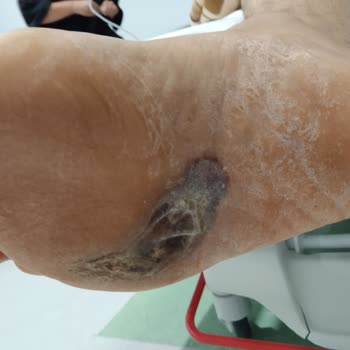 Sağlık Bakanlığı Sözde Adı Büyük Şehir Hastanesi