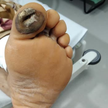 Sağlık Bakanlığı Sözde Adı Büyük Şehir Hastanesi