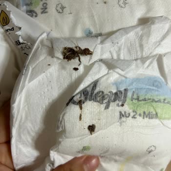 Sleepy Bio Natural Bebek Bezinde Güve Sorunu