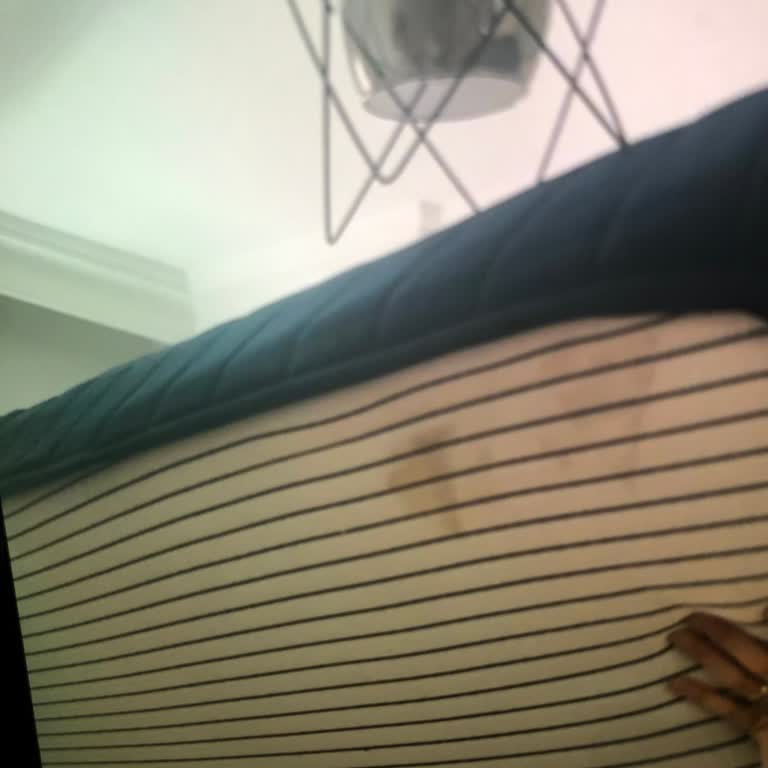 Markasi Hospital Revizyon Yatak Odası