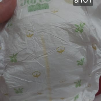 A101 Ya Sahte Ya Defolu Ürün