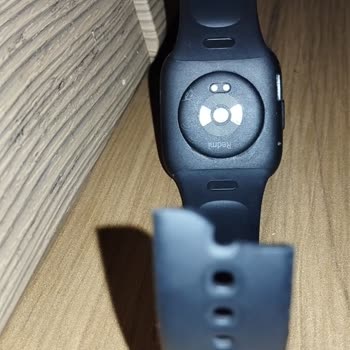 Xiaomi Redmi Watch 3 Kordon Kopması