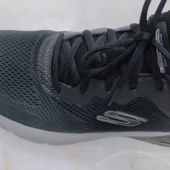 Skechers İn Cevabi Beni Daha Çok Üzdü.
