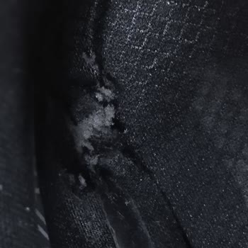 Skechers İn Cevabi Beni Daha Çok Üzdü.