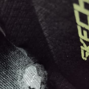 Skechers İn Cevabi Beni Daha Çok Üzdü.