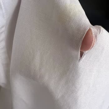 Dry Center'da Kuru Temizleme Kabusu: Pantolon Yırtıldı Ve Lekeler Kaldı