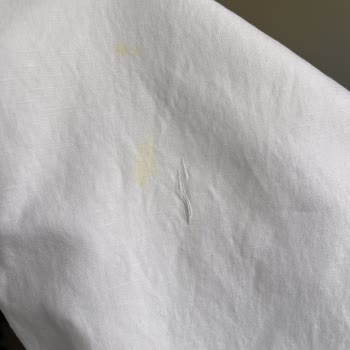 Dry Center'da Kuru Temizleme Kabusu: Pantolon Yırtıldı Ve Lekeler Kaldı