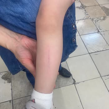 A101 Raflarındaki Düzensizlik Kazaya Sebep Oldu!