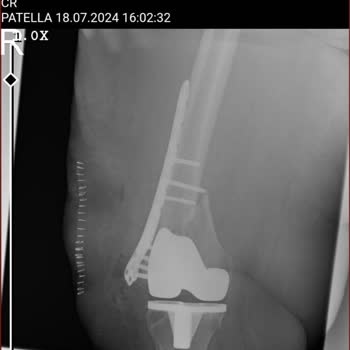Sakarya Yenikent Devlet Hastanesi Dikkat Sizinde Başınıza Gelemesin