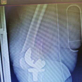 Sakarya Yenikent Devlet Hastanesi Dikkat Sizinde Başınıza Gelemesin