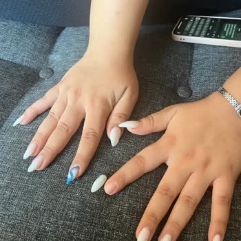 Vip Estetik Güzellik Kötü Hizmet Ve Kalitesiz Malzeme Kullanımı