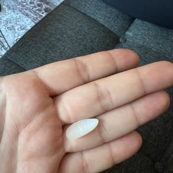 Vip Estetik Güzellik Kötü Hizmet Ve Kalitesiz Malzeme Kullanımı