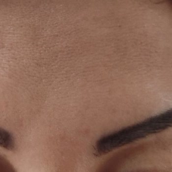 Dr Beauty İstanbul Dr_Beauty İstanbul Hatalı Yapılan İşlem Ve Sorumluluk Almaması