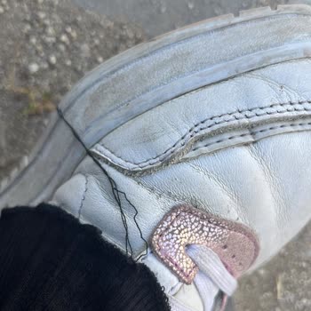 Adidas Ürünümün Kırılma Ve Açılma Problemleri