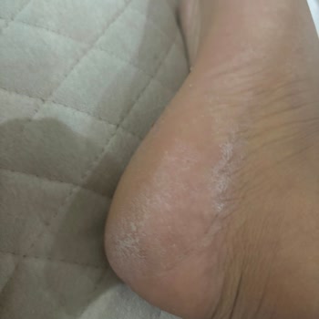 Divaform Güzellik Merkezi Yeni Eleman Sorunsalı