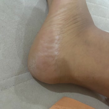 Divaform Güzellik Merkezi Yeni Eleman Sorunsalı