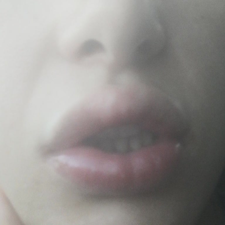 Health Issues Caused by Parodontax Toothpaste