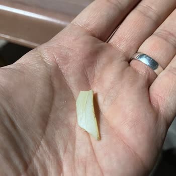 Seyran Gıda A101 Yabancı Cisim Çıkan Çerez Ve Sonrasındaki Komedi