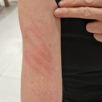 Gümüşmall Şiddete Maruz Kaldık