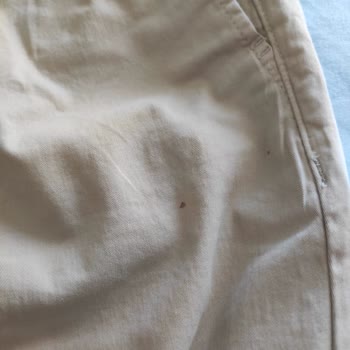 Zara Ayıplı Ürünü İade Almıyor