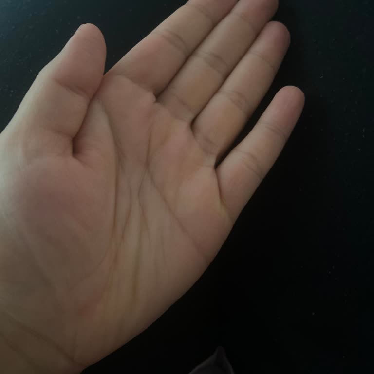 Aras Kargo Yanlış Teslimat Ve Kargo Sorunu